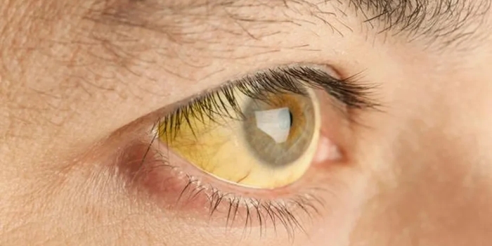 Foto de capa da notícia