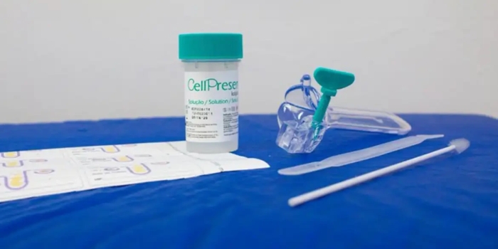 Foto de capa da notícia