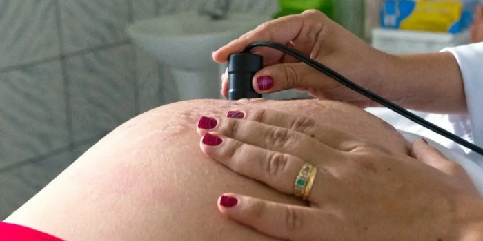 Foto de capa da notícia