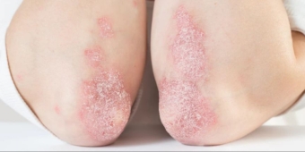 Imagem de capa da notícia