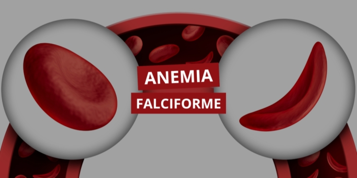 Foto de capa da notícia