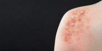 Imagem de capa da notícia