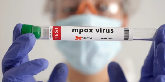 Foto de capa da notícia