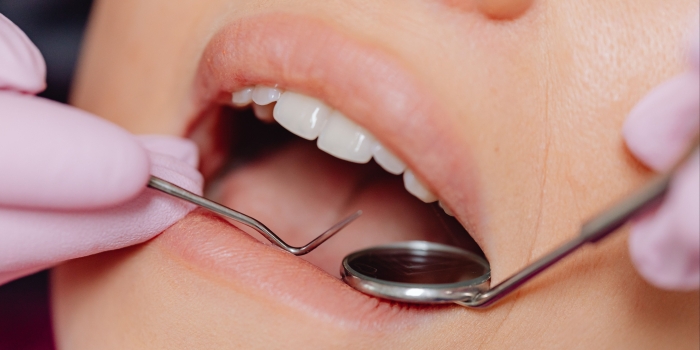 Foto de capa da notícia